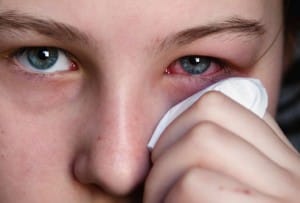 Qu&rsquo;est ce que l&rsquo;allergie oculaire?