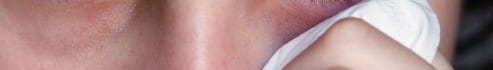 Qu&rsquo;est ce que l&rsquo;allergie oculaire?