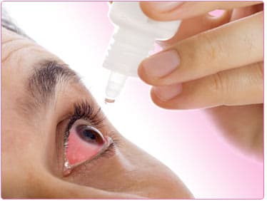 Les symptômes de l&#8217;allergie des yeux